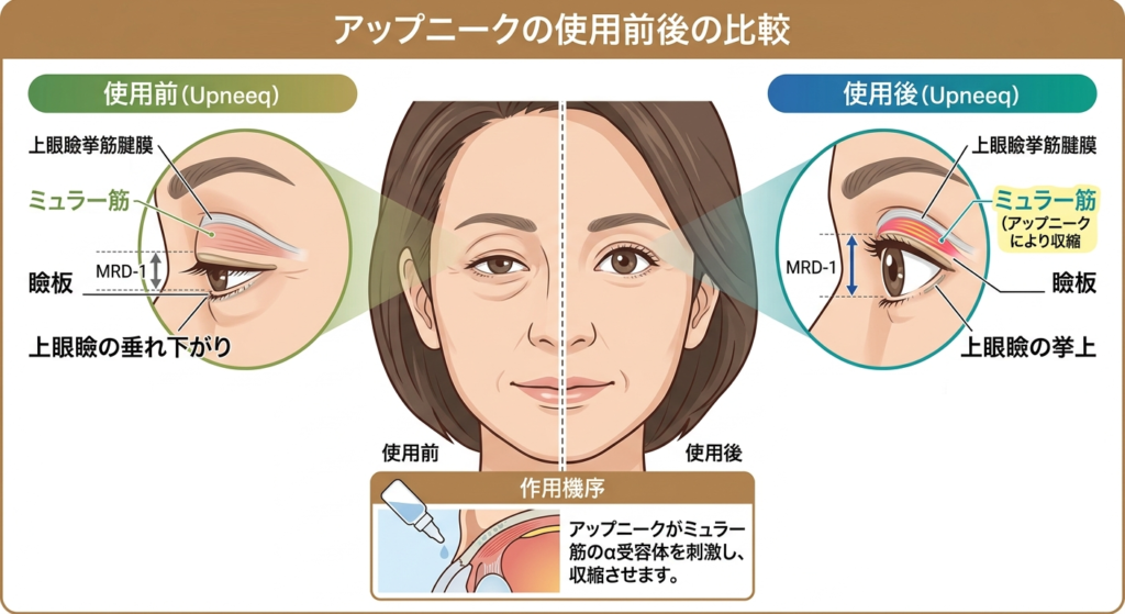 アップニークの作用メカニズム